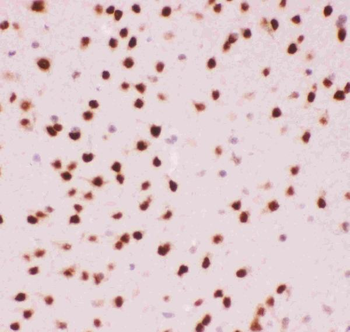 Anti-ATF2 Antibody