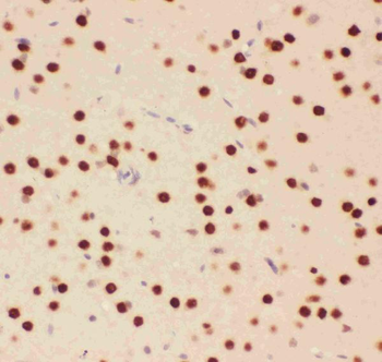 Anti-ATF2 Antibody