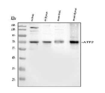 Anti-ATF2 Antibody