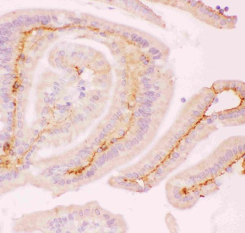 Anti-MCL1 Antibody