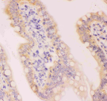 Anti-MCL1 Antibody