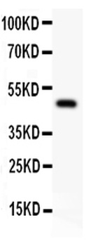 alpha 1 Catenin/CTNNA1 Antibody