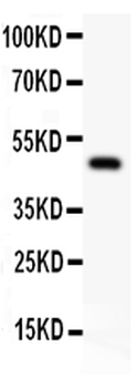 Anti-alpha 1 Catenin/CTNNA1 Antibody