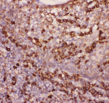 Anti-CD11b/ITGAM Antibody