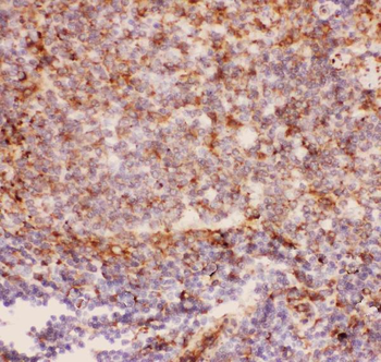 Anti-CD11b/ITGAM Antibody