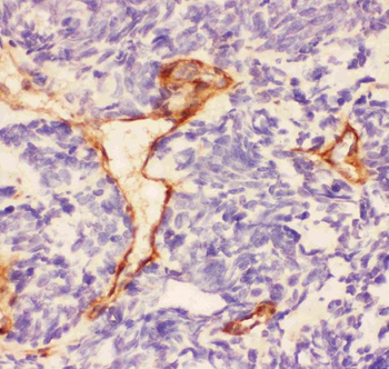 Anti-Laminin/Lamc1/Lamc2/Lamc3 Antibody