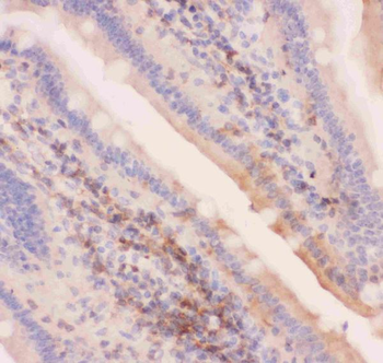 Anti-MRP4/ABCC4 Antibody
