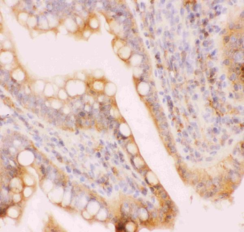 Anti-MRP4/ABCC4 Antibody