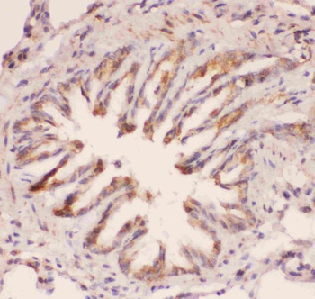 Anti-MyD88 Antibody