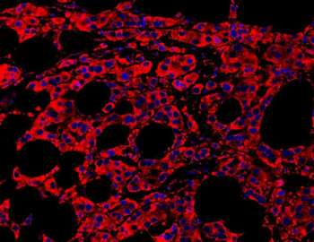 Anti-MyD88 Antibody