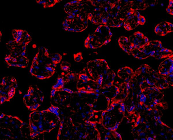 Anti-MyD88 Antibody