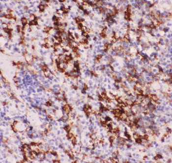 Anti-MyD88 Antibody