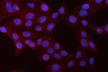 Anti-NFkB/NFKB1 p105/p50 Antibody