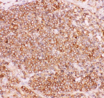 NFkB/NFKB2 p100/p52 Rabbit Polyclonal Antibody