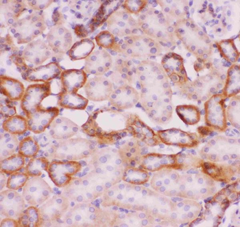 Anti-Sodium/Hydrogen Exchanger 1/SLC9A1 Antibody