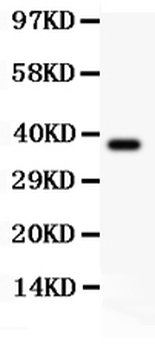 Anti-Sodium/Hydrogen Exchanger 1/SLC9A1 Antibody