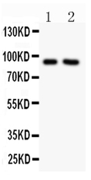 Anti-Sodium/Hydrogen Exchanger 1/SLC9A1 Antibody