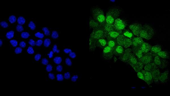 Anti-p63/TP63 Antibody
