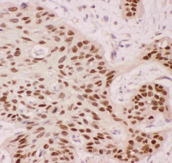 Anti-p63/TP63 Antibody