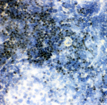 Anti-RUNX1/AML1 Antibody