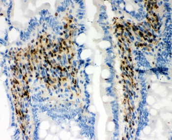 Anti-RUNX1/AML1 Antibody