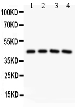 Anti-SIRT3 Antibody