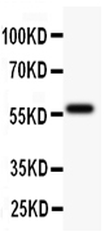 Anti-TdT/DNTT Antibody