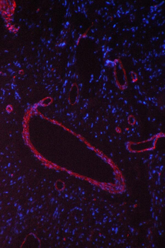 Anti-Caveolin-1/CAV1 Antibody