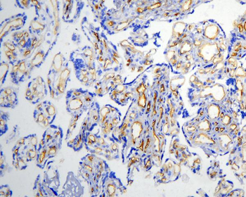 Anti-Caveolin-1/CAV1 Antibody