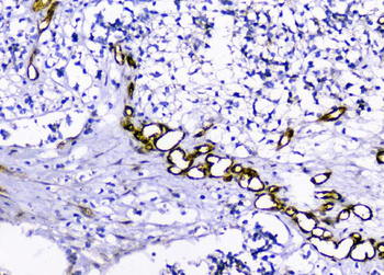 Anti-Caveolin-1/CAV1 Antibody