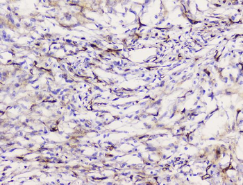 Anti-Caveolin-1/CAV1 Antibody