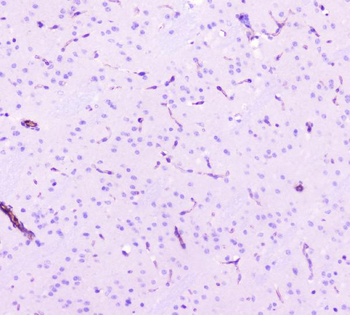 Anti-Caveolin-1/CAV1 Antibody