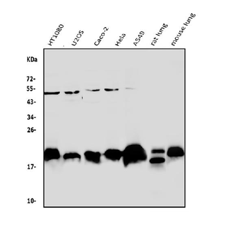 Anti-Caveolin-2/CAV2 Antibody