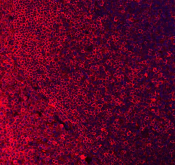 Anti-CD79a Antibody