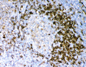 Anti-CD79a Antibody