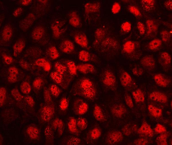 Anti-CD79b Antibody