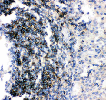 Anti-CD79b Antibody