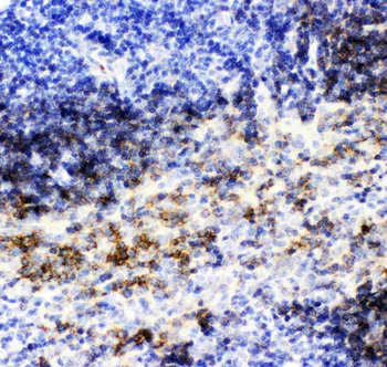 Anti-CD79b Antibody