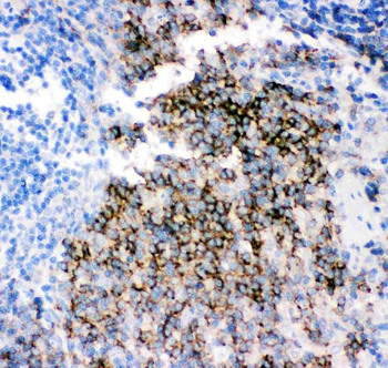 Anti-CD79b Antibody