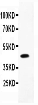 Anti-CD79b Antibody