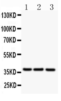 Anti-CD79b Antibody
