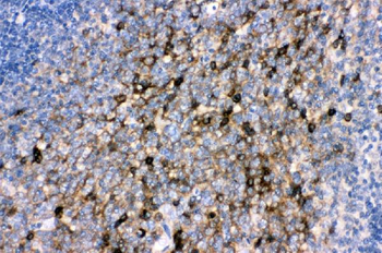 Anti-CD82 Antibody