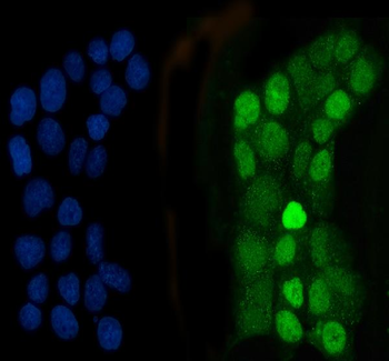Anti-CEBP Beta/CEBPB Antibody