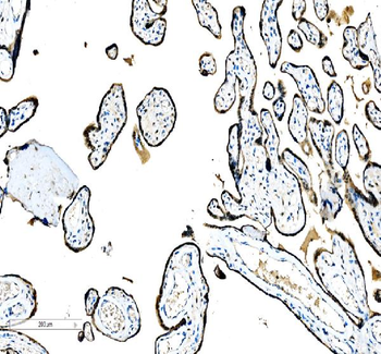 Anti-CEBP Beta/CEBPB Antibody