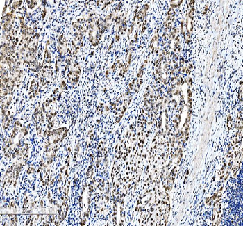 Anti-CEBP Beta/CEBPB Antibody