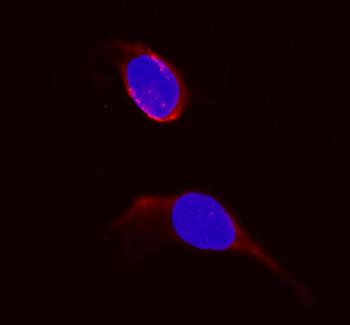 Anti-Dihydrofolate reductase (DHFR) Antibody