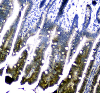 Anti-Dihydrofolate reductase (DHFR) Antibody