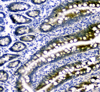 Anti-Dihydrofolate reductase (DHFR) Antibody