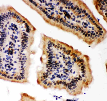 Anti-KAT3B/p300/EP300 Antibody