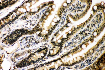 Anti-KAT3B/p300/EP300 Antibody